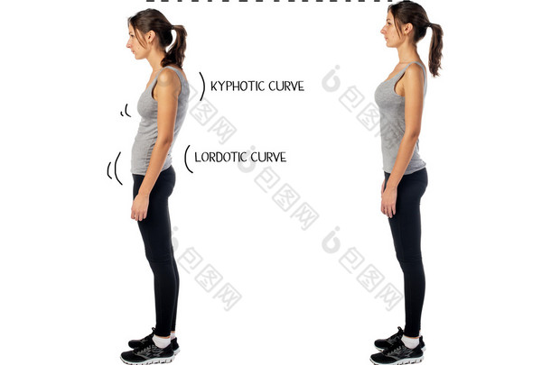 姿态障碍、体位缺损、脊柱侧<strong>弯</strong>及理想负压的妇女