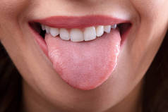 特写镜头的一个女人的脸显示她干净的舌头