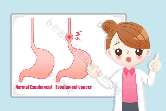 女医生教授食管癌的医学知识