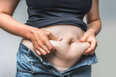 超重的女人身体用手触摸腹部脂肪