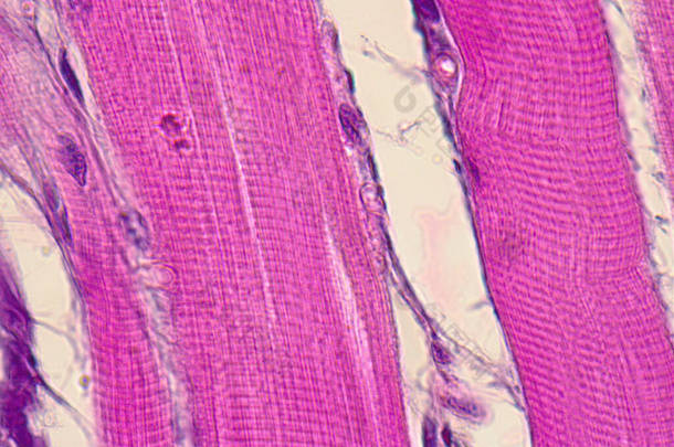 显微镜下<strong>条状</strong>肌肉组织.