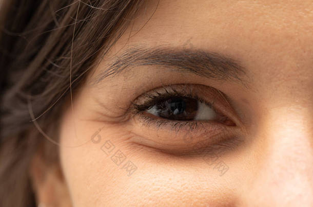 在一个年轻漂亮的女人的眼中，这是一个特写镜头。眼袋浮肿的细节是由<strong>皮肤</strong>下面的液体保留引起的。眼睑整形手术前的女士