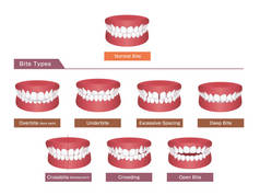 Teeth trouble ( bite type ) vector illustration set