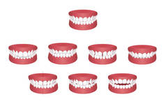 Teeth trouble ( bite type ) vector illustration set