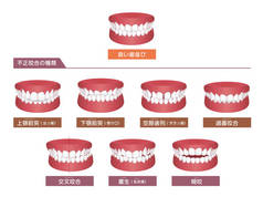 Teeth trouble ( bite type ) vector illustration set