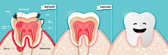 关于坏牙齿和好牙齿载体的健康科学纸艺