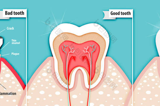 关于坏牙齿和好牙齿载体的健康科学纸艺