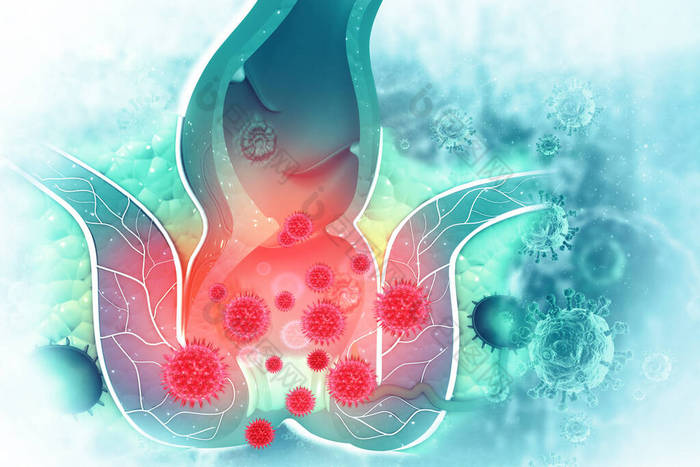以科学为背景的痔疮(堆积物)疾病.3d说明
