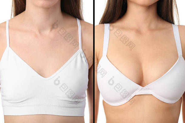 胸部大小不同、<strong>背景</strong>为白色的年轻女人的胸围。<strong>整形</strong>外科概念