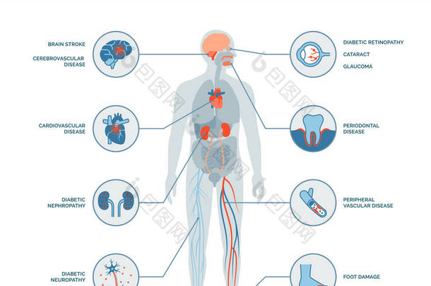 糖尿病的长期<strong>并发症</strong>