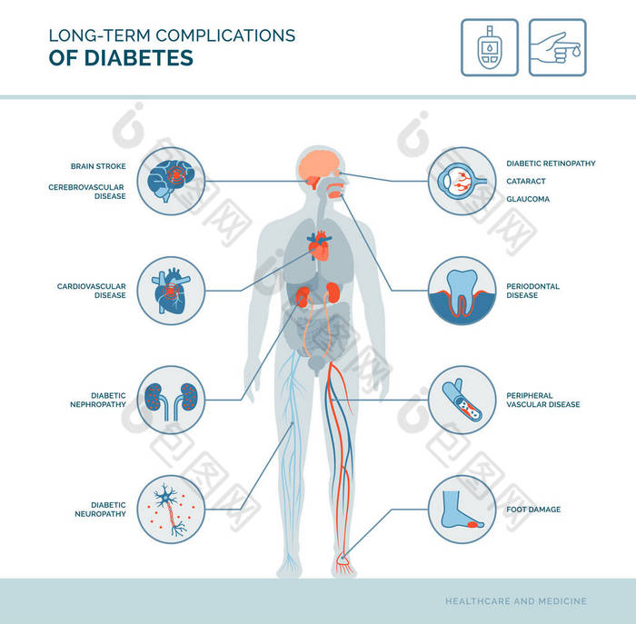 糖尿病的长期并发症