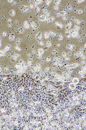 显微镜视图结肠癌症细胞组织文化显示墙核而且细胞器