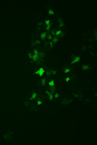 微观视图BOSC组织文化细胞表达绿色荧光蛋白质绿色荧光蛋白使用监控病毒表达式