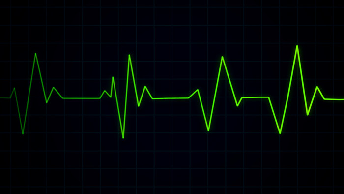 绿色心跳脉冲心电图屏幕心电图心电图有氧运动医疗保健概念