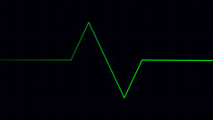 绿色心跳脉冲心电图屏幕心电图心电图有氧运动医疗保健概念