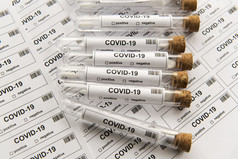 许多新冠病毒测试管为很多测试