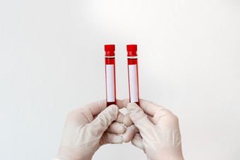 提取血样本瓶准备好了为医疗诊断检查实验室技术员持有测试管提取人类血样本为健康风险诊断工具医疗研究分析概念