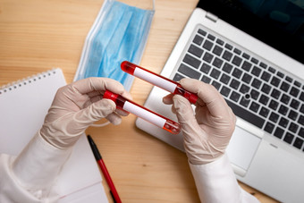 提取血样本瓶与最新的技术准备好了为检<strong>查分</strong>析实验室测试管提取人类血样本与现代设备小工具移动PC为健康风险诊断工具