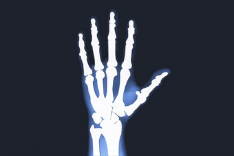 x射线检查人类手x射线手骨头x射线检查人类手x射线手骨头