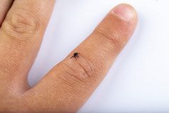 危险的蜱虫爬手指小孩子们和看起来为血为咬
