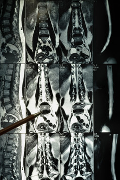 磁共振成像人类颈在的行脊柱x射线电影