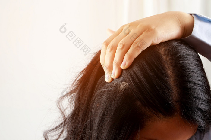 女人有问题与头发和头皮她有头皮屑从过敏反应洗发水和头发护发素