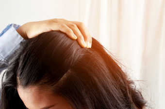 女人有问题与头发和头皮她有头皮屑从过敏反应<strong>洗发水</strong>和头发<strong>护发</strong>素