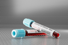 新冠病毒测试检测测试管测试室包含血样本插图