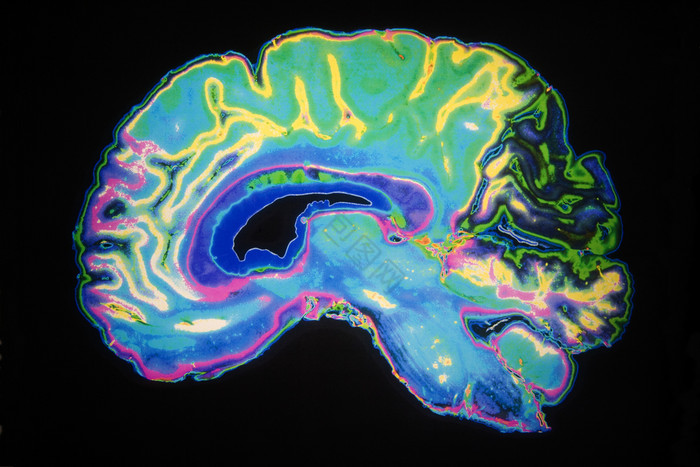 人为地彩色核磁共振扫描人类大脑图片