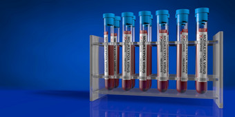 集团测试管持有人反光表格与血样品积极的为猴痘对黑暗蓝色的背景插图集团测试管架与血样品积极的为猴痘对蓝色的背景插图