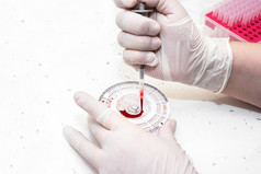 关闭视图实验室设备血受污染的冠状病毒和样本被分析了关闭视图实验室设备血受污染的冠状病毒和样本被分析了