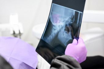 牙医解释的细节x射线图片她的病人高质量照片牙医解释的细节x射线图片她的病人