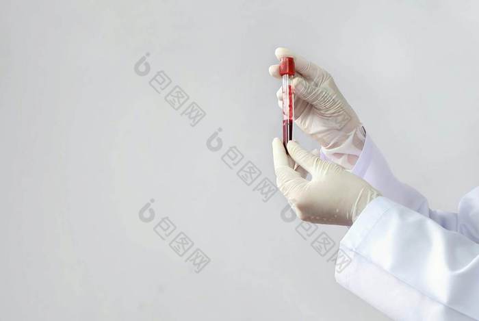 关闭女医生的手白色外套和医疗手套持有测试管真空采血管与红色的血为测试血液学实验室医院医疗和科学概念