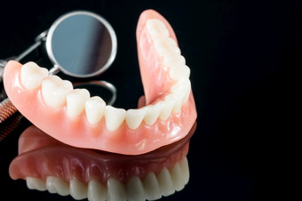 牙齿模型显示植入物皇冠桥模型牙科示范牙齿研究教模型牙齿模型显示植入物皇冠桥模型
