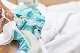 病人亚洲老女性气管造口术使用呼吸机为呼吸呼吸帮助病人床上密集的哪单位伊库房间医院病人气管造口术和呼吸机医院