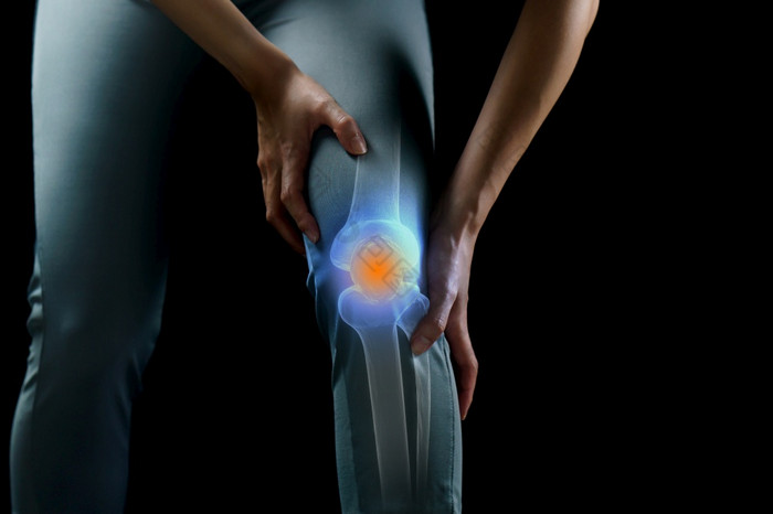 女人持有她的手的膝盖疼痛的膝盖突出显示蓝色的医学按摩概念