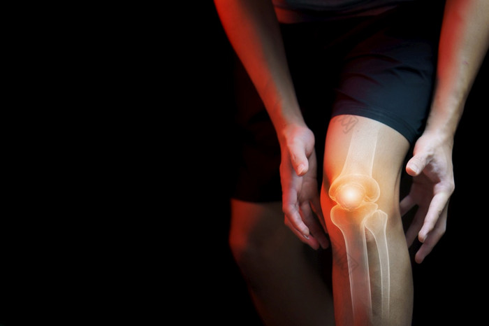 医疗概念男人。痛苦与膝盖痛苦的骨架x射线