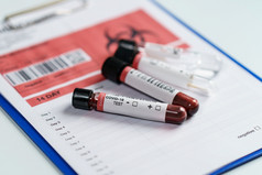 血测试样品管试剂测试管和拭子集合工具包的实验室冠状病毒测试过程假的代码和条形码