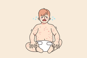 不开心婴儿婴儿哭遭受从湿疹皮肤病学疾病心烦意乱伤心小孩子新生儿孩子强调与麻疹水痘孩子们医疗保健概念向量插图不开心婴儿哭遭受从湿疹疾病图片