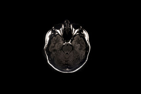 大脑扫描成像的大脑射线