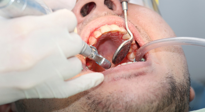 口出血的牙医办公室图片