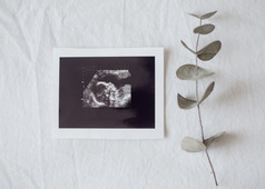 前视图雷照片胎儿决议和高质量美丽的照片前视图雷照片胎儿高质量和决议美丽的照片概念