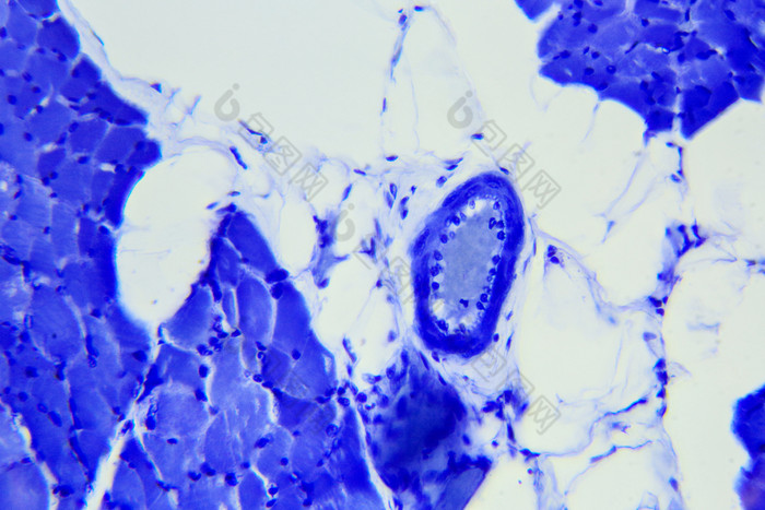 骨骼肌肉组织纵向部分下显微镜骨骼肌肉