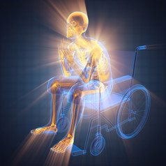 射线照相法男人。轮椅