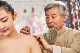 老中医对病人肩膀进行针灸治疗皮肤高质量影相