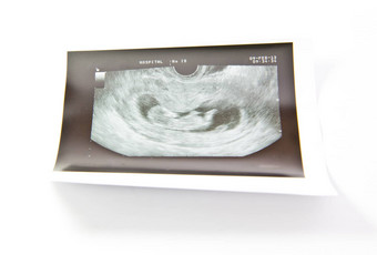 周婴儿超声波图像