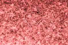 埃博拉病毒病毒