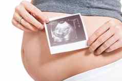 怀孕了女人显示产前超声波