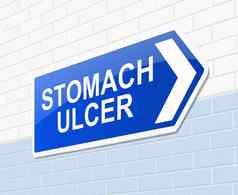 胃溃疡概念