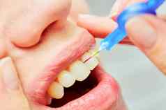 正确的牙刷完美的口服卫生